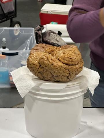 human brain